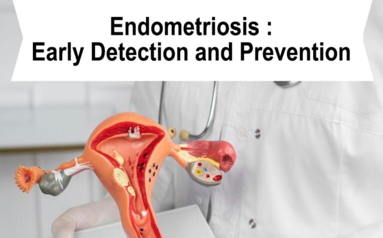 Endometriosis: Early Detection and Prevention