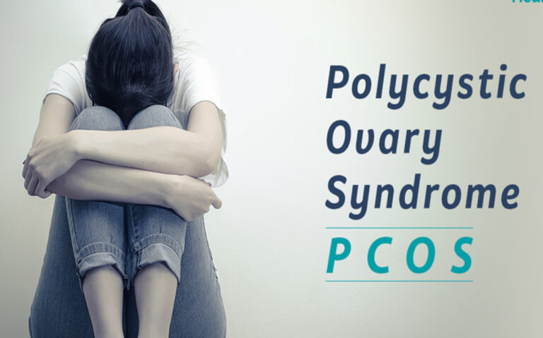 FAQS OF PCOS