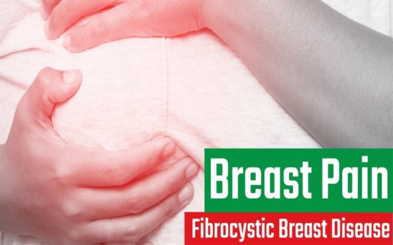 FAQs of FIBROCYSTIC BREASTS AND HOMEOPATHY