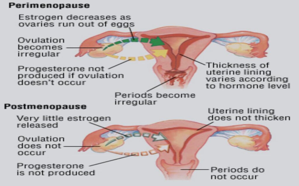 COMMON SIGNS AND SYMPTOMS OF MENOPAUSE
