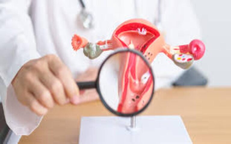 Uterine Fibroids and Homeopathy: A Natural Approach to Healing