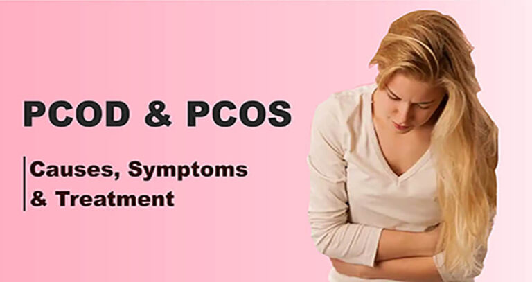PCOD AND PCOS: CAUSES, SYMPTOMS AND TREATMENT